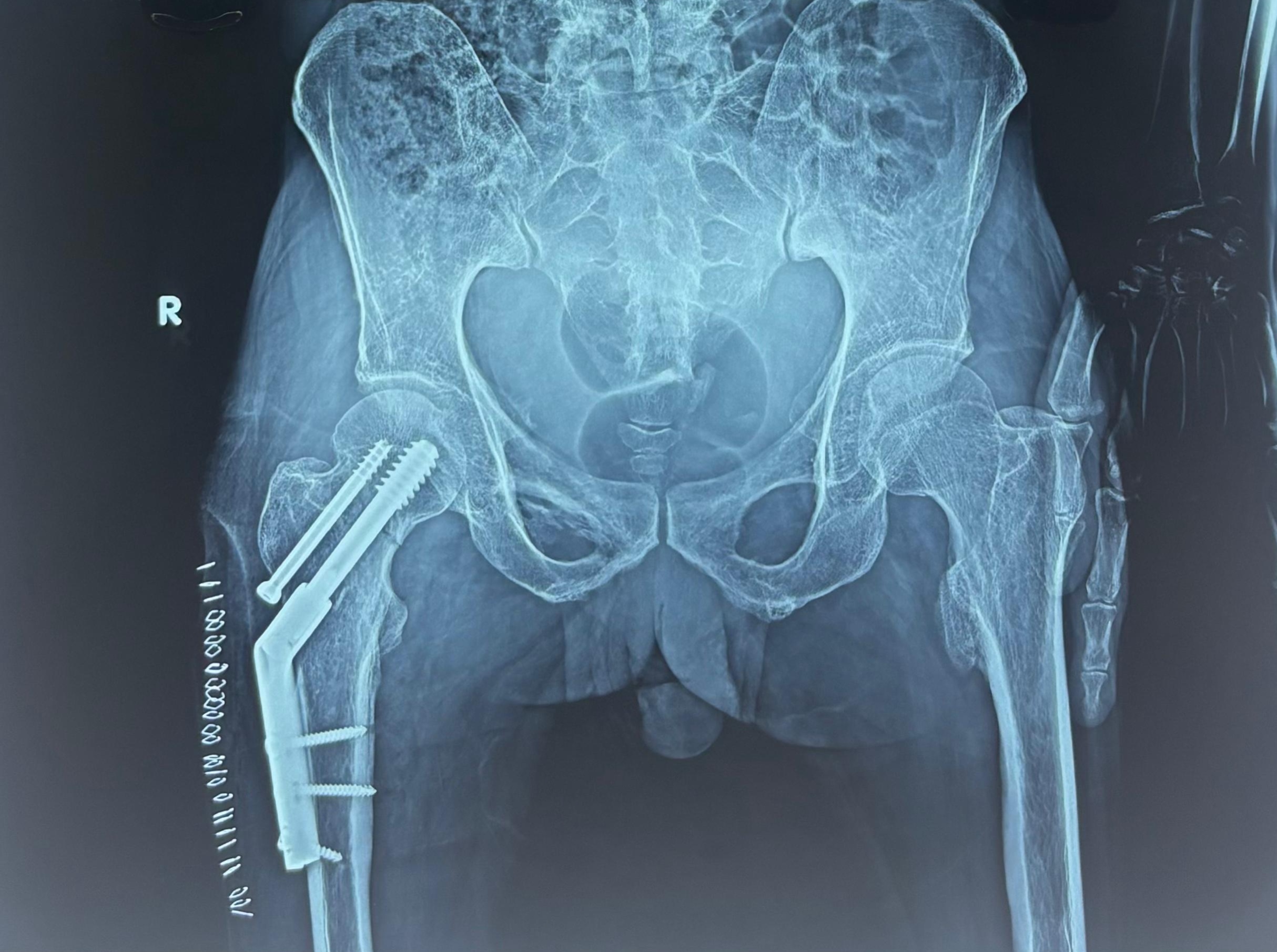 Explanation Image