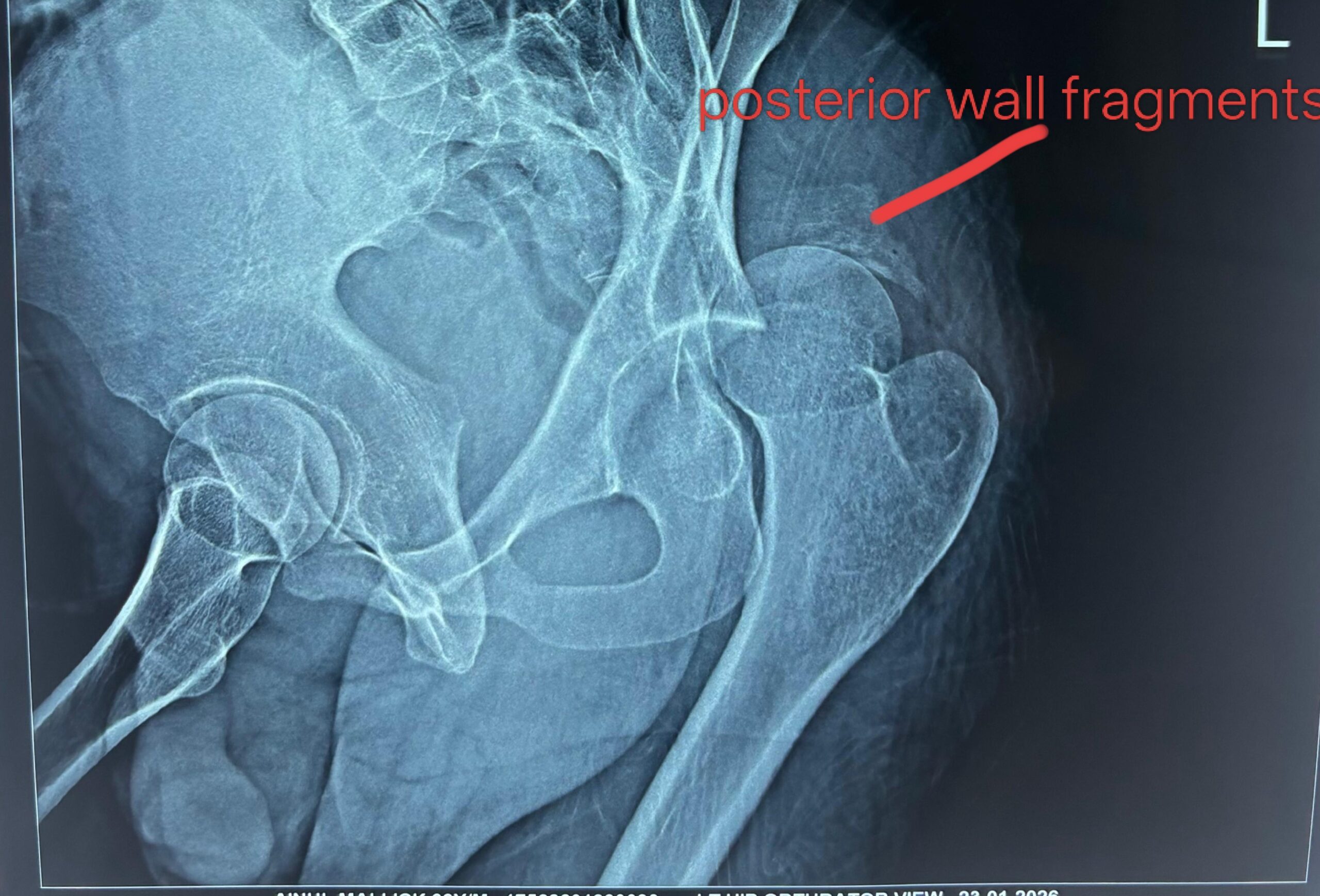 Explanation Image